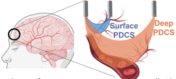 pdcs512.png